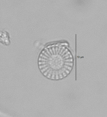 Stephanodiscus minutulus