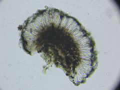 Lecidea turgidula