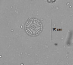 Stephanodiscus minutulus