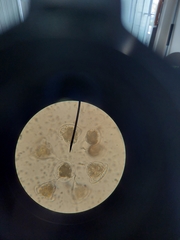 Vorticella campanula