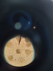 Vorticella campanula