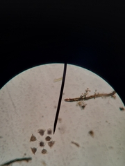 Vorticella campanula