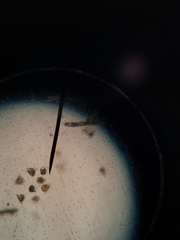 Vorticella campanula