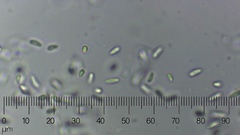 Eriopezia caesia