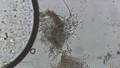 Eriopezia caesia