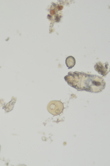 Centropyxis aculeata