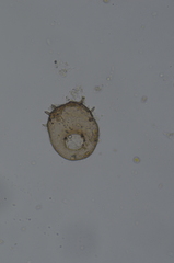 Centropyxis aculeata