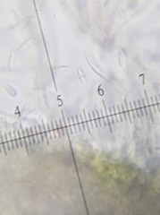 Coenogonium fruticulosum