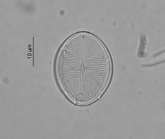 Cocconeis