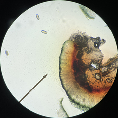 Mycoblastus sanguinarioides