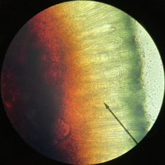 Mycoblastus sanguinarioides