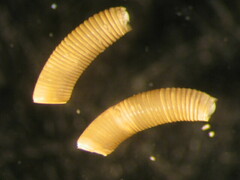 Caecum