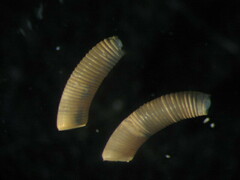 Caecum