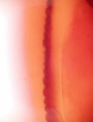 Aleuropleurocelus nigrans