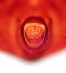 Aleuropleurocelus nigrans