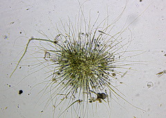 Gloeotrichia