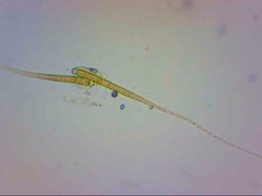 Calothrix
