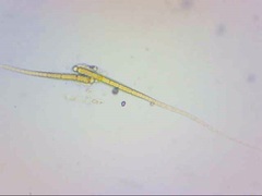 Calothrix