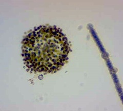 Microcystis