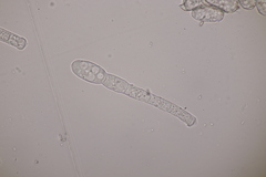 Podosphaera euphorbiae