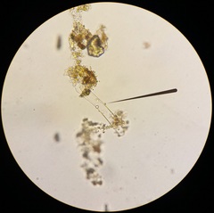 Achlya racemosa