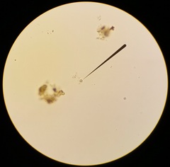 Amphora ovalis