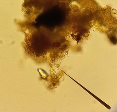 Hymenolepis
