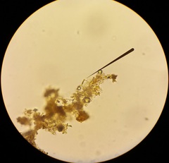 Amphora ovalis