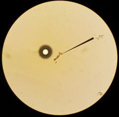 Planktothrix rubescens