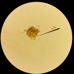 Phycopeltis