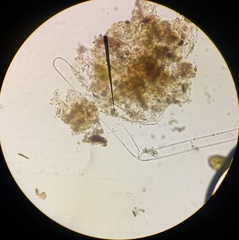 Achlya racemosa