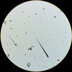 Planktothrix rubescens