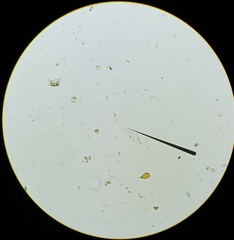 Achlya racemosa