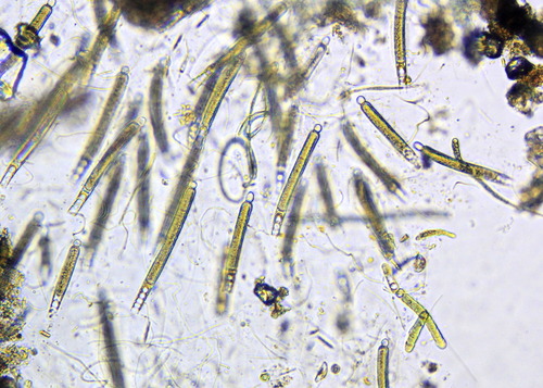 Gloeotrichia natans observed 2022-08-07