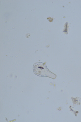 Hyalosphenia