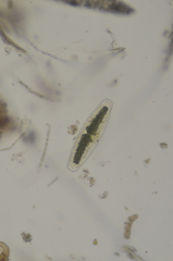 Netrium digitus