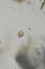 Centropyxis aculeata