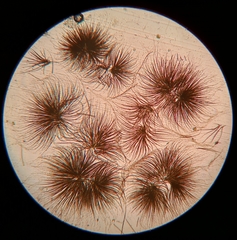 Gloeotrichia echinulata