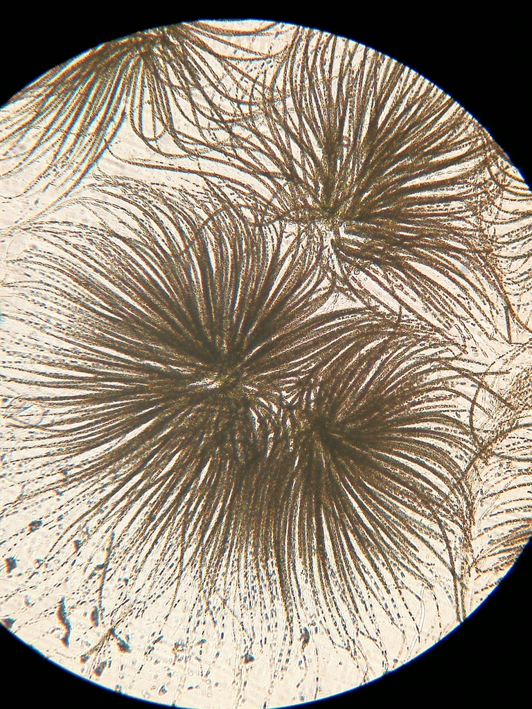 Gloeotrichia echinulata