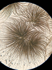 Gloeotrichia echinulata