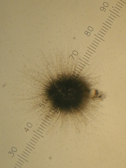 Gloeotrichia echinulata