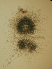 Gloeotrichia echinulata