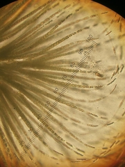 Gloeotrichia echinulata