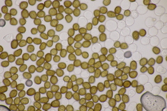 Macalpinomyces neglectus