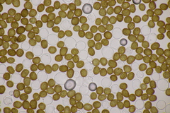Macalpinomyces neglectus