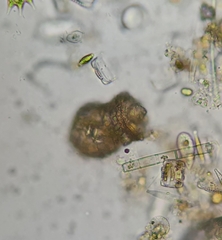 Codonella cratera