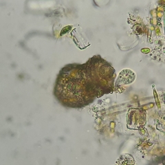 Codonella cratera