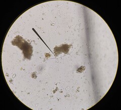 Planktothrix rubescens