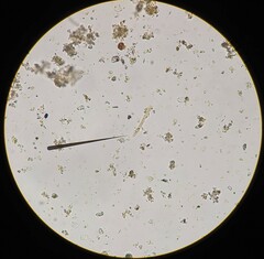 Planktothrix rubescens