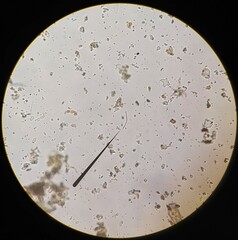 Planktothrix rubescens